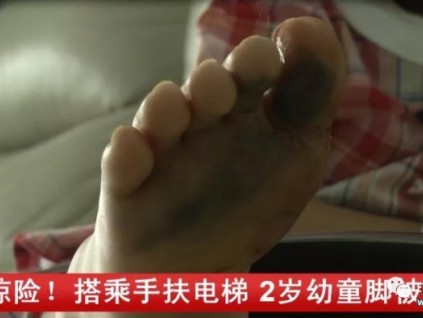 危險！2歲幼童搭乘手扶電梯，腳被卡進(jìn)縫隙……